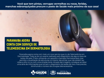 Saúde oferece serviço de dermatologia